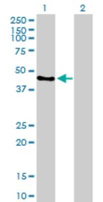 Western Blot: IRF9 Antibody [H00010379-D01P] - Analysis of IRF9 expression in transfected 293T cell line by IRF9 polyclonal antibody.Lane 1: IRF9 transfected lysate(43.70 KDa).Lane 2: Non-transfected lysate.