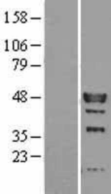 Western Blot: IRF9 Overexpression Lysate (Adult Normal) [NBL1-12038] Left-Empty vector transfected control cell lysate (HEK293 cell lysate); Right -Over-expression Lysate for IRF9.