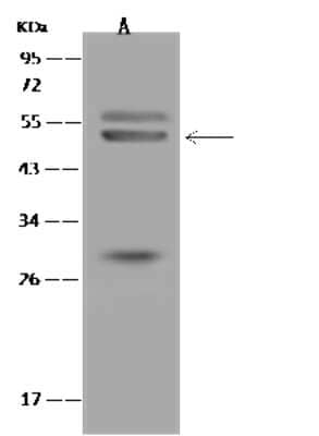 Western Blot: IRG1 Antibody [NBP3-06244] - Anti-IRG1 rabbit polyclonal antibody at 1:500 dilution.