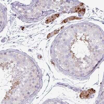 Immunohistochemistry-Paraffin: IRGC Antibody [NBP2-14129] - Staining of human testis shows strong cytoplasmic positivity in Leydig cells.