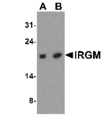 Western Blot: IRGM Antibody [NBP1-76377] - Analysis of IRGM expression in SK-N-SH cell lysate with IRGM antibody at (A) 1 and (B) 2 ug/ml.