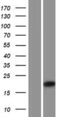 Western Blot: IRGM Overexpression Lysate (Adult Normal) [NBP2-09763] Left-Empty vector transfected control cell lysate (HEK293 cell lysate); Right -Over-expression Lysate for IRGM.