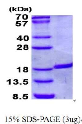 SDS-Page: IRGM Protein [NBP2-23131]