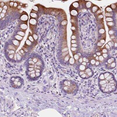 Immunohistochemistry-Paraffin: IRP2 Antibody [NBP2-49576] - Staining of human small intestine shows strong cytoplasmic positivity in glandular cells.