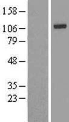 Western Blot IRP2 Overexpression Lysate