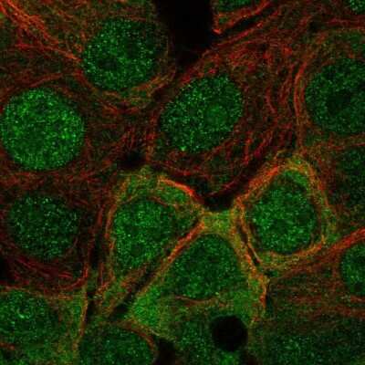 Immunocytochemistry/Immunofluorescence: IRS1 Antibody [NBP2-68666] - Staining of human cell line MCF7 shows localization to nucleus, plasma membrane & cytosol.