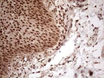 Immunohistochemistry: IRS1 Antibody (OTI3G10) - Azide and BSA Free [NBP2-71049] - Analysis of Human bladder tissue. (Heat-induced epitope retrieval by 1mM EDTA in 10mM Tris buffer (pH8.5) at 120C for 3 min)