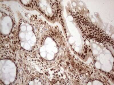 Immunohistochemistry: IRS1 Antibody (OTI3G10) - Azide and BSA Free [NBP2-71049] - Analysis of Human colon tissue. (Heat-induced epitope retrieval by 1mM EDTA in 10mM Tris buffer (pH8.5) at 120C for 3 min)