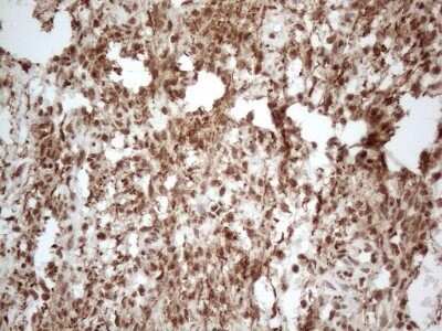 Immunohistochemistry: IRS1 Antibody (OTI3G10) - Azide and BSA Free [NBP2-71049] - Analysis of Human endometrium tissue. (Heat-induced epitope retrieval by 1mM EDTA in 10mM Tris buffer (pH8.5) at 120C for 3 min)