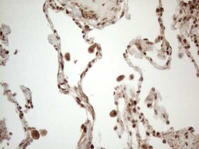 Immunohistochemistry: IRS1 Antibody (OTI3G10) - Azide and BSA Free [NBP2-71049] - Analysis of Human lung tissue. (Heat-induced epitope retrieval by 1mM EDTA in 10mM Tris buffer (pH8.5) at 120C for 3 min)