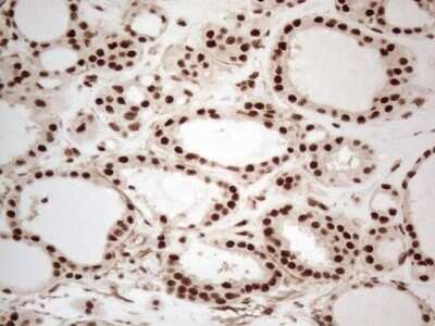 Immunohistochemistry: IRS1 Antibody (OTI3G10) - Azide and BSA Free [NBP2-71049] - Analysis of Human thyroid tissue. (Heat-induced epitope retrieval by 1mM EDTA in 10mM Tris buffer (pH8.5) at 120C for 3 min)