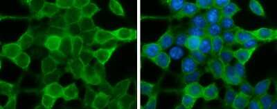 Immunocytochemistry/ Immunofluorescence IRS4 Antibody