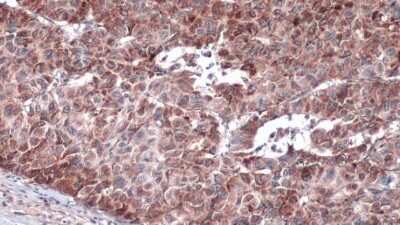 Immunohistochemistry-Paraffin IRS4 Antibody