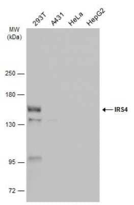 Western Blot IRS4 Antibody