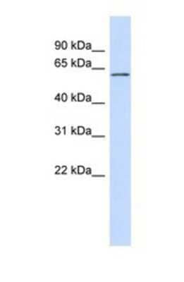 Western Blot FCRL4/FcRH4/IRTA1 Antibody