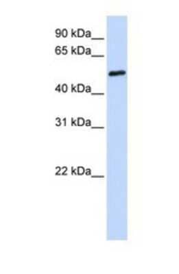 Western Blot: IRTA1 Antibody [NBP1-69384] - This Anti-FCRL4 antibody was used in Western Blot of Fetal Brain tissue lysate at a concentration of 1ug/ml.