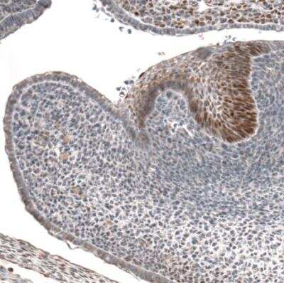 Immunohistochemistry-Paraffin: IRX1 Antibody [NBP1-83090] - Staining of mouse embryo E14 shows moderate to strong nuclear positivity in developing teeth.