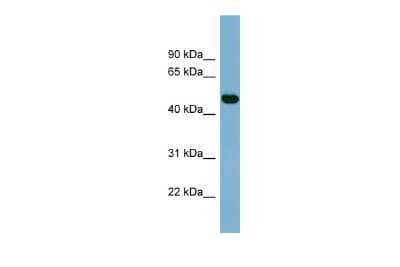 Western Blot: IRX1 Antibody [NBP2-85108] - WB Suggested Anti-IRX1 Antibody Titration: 0.2-1 ug/ml. ELISA Titer: 1:12500. Positive Control: Human Small Intestine