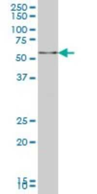Western Blot: IRX3 Antibody (3E7) [H00079191-M10] - Analysis of IRX3 expression in A-431 (Cat # L015V1).