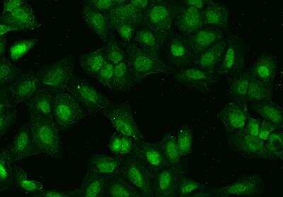Immunocytochemistry/Immunofluorescence: IRX4 Antibody [NBP3-06171] - Staining of IRX4 in U2OS cells. Cells were fixed with 4% PFA, permeabilzed with 0.1% Triton X-100 in PBS,blocked with 10% serum, and incubated with rabbit anti-Human IRX4 polyclonal antibody (dilution ratio 1:500) at 4? overnight. Then cells were stained with the Alexa Fluor®488-conjugated Goat Anti-rabbit IgG secondary antibody (green). Positive staining was localized to Nucleus and cytoplasm.