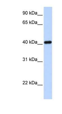 Western Blot: IRX6 Antibody [NBP1-79257] - 293T cells lysate, concentration 0.2-1 ug/ml.