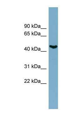 Western Blot: IRX6 Antibody [NBP1-79259] - PANC1 cell lysate, concentration 0.2-1 ug/ml.