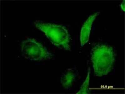 Immunocytochemistry/Immunofluorescence: ISCU Antibody (3B8-1C4) [H00023479-M01] - Analysis of monoclonal antibody to NIFUN on HeLa cell. Antibody concentration 10 ug/ml.