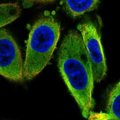 Immunocytochemistry/Immunofluorescence: ISCU Antibody [NBP2-38420] - Immunofluorescent staining of human cell line PC-3 shows localization to cytosol.