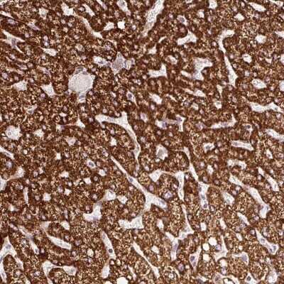 Immunohistochemistry: ISCU Antibody [NBP2-38420] - Staining of human liver shows strong cytoplasmic positivity in hepatocytes.