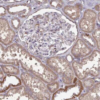 Immunohistochemistry-Paraffin: ISCU Antibody [NBP2-38829] - Staining of human kidney shows moderate cytoplasmic positivity in cells in tubules.