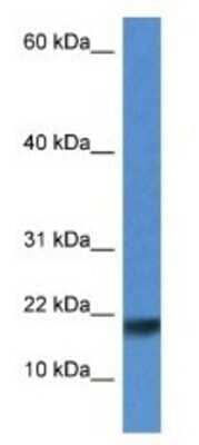 Western Blot: ISCU Antibody [NBP1-74072] - Rat Lung Lysate 1ug/ml  Gel Concentration 10-20%