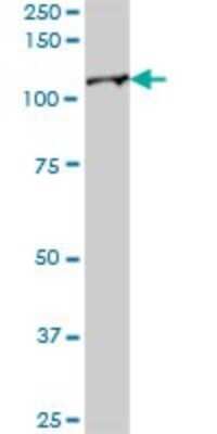 Western Blot: ISG15 Activating Enzyme/UBE1L Antibody [H00007318-B02P] - Analysis of UBE1L expression in human liver.