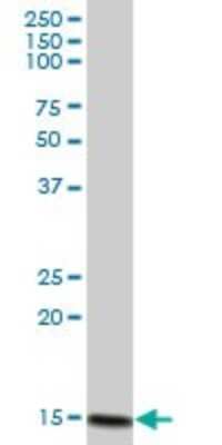 Western Blot: ISG15/UCRP Antibody [H00009636-B01P] - Analysis of G1P2 expression in human pancreas.