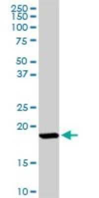 Western Blot: ISG15/UCRP Antibody [H00009636-D01P] - Analysis of ISG15 expression in mouse kidney.