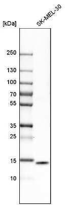 Western Blot: ISG15/UCRP Antibody [NBP1-89809] - Analysis in human cell line SK-MEL-30.