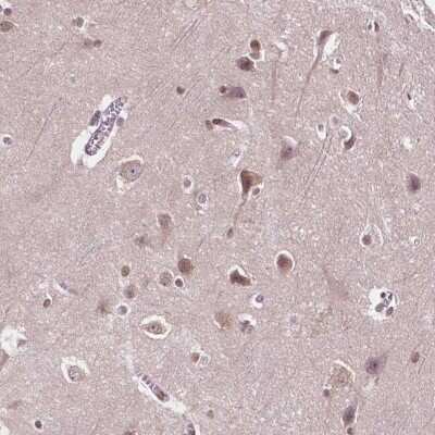 Immunohistochemistry: ISLR-2 Antibody [NBP2-49515] - Staining of human cerebral cortex shows moderate nuclear positivity in neuronal cells.