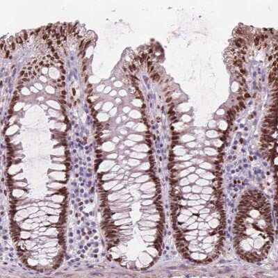 Immunohistochemistry-Paraffin: ISLR-2 Antibody [NBP2-48522] - Staining of human colon shows moderate nuclear positivity in glandular cells.