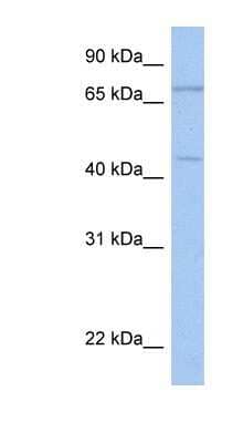 Western Blot: ISLR-2 Antibody [NBP1-91341] - Hela cell lysate, concentration 0.2-1 ug/ml.