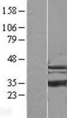 Western Blot: ISOC1 Overexpression Lysate (Adult Normal) [NBL1-12053] Left-Empty vector transfected control cell lysate (HEK293 cell lysate); Right -Over-expression Lysate for ISOC1.