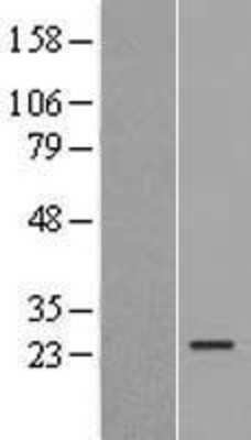 Western Blot: ISOC2 Overexpression Lysate (Adult Normal) [NBL1-12054] Left-Empty vector transfected control cell lysate (HEK293 cell lysate); Right -Over-expression Lysate for ISOC2.
