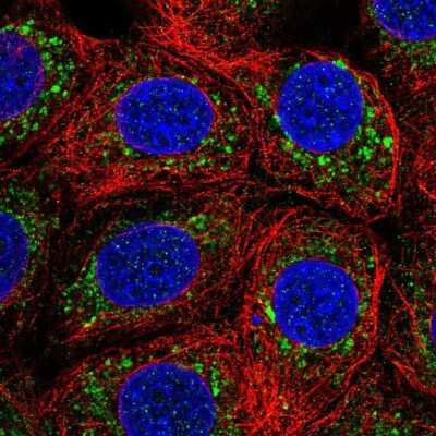 Immunocytochemistry/Immunofluorescence: IST1 Antibody [NBP2-33720] - Immunofluorescent staining of human cell line MCF7 shows localization to vesicles. Antibody staining is shown in green.