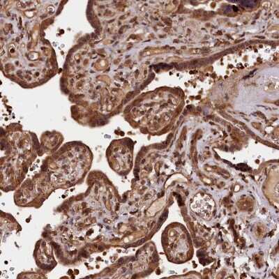 Immunohistochemistry-Paraffin IST1 Antibody