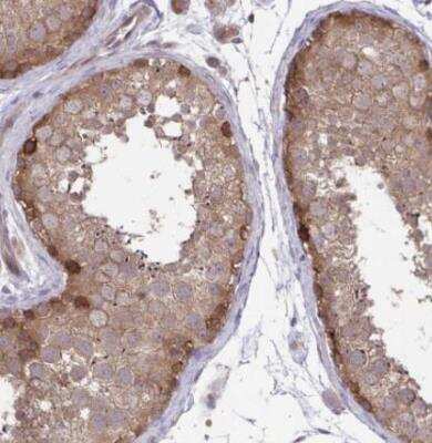 Immunohistochemistry-Paraffin IST1 Antibody