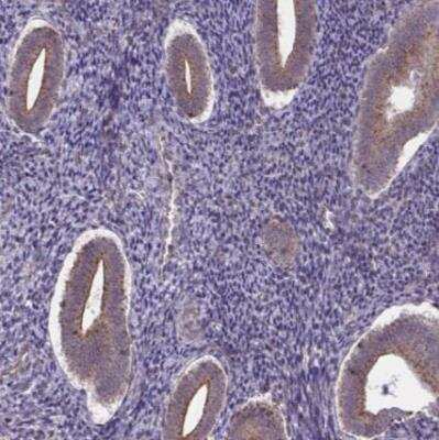 Immunohistochemistry-Paraffin IST1 Antibody