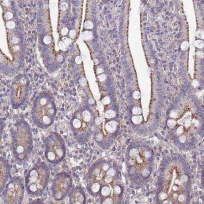 Immunohistochemistry-Paraffin: IST1 Antibody [NBP2-33720] - Staining of human duodenum shows moderate granular cytoplasmic positivity in glandular cells.