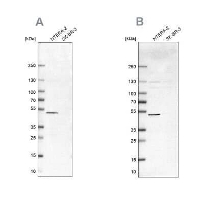 Western Blot IST1 Antibody