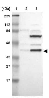 Western Blot: ISY1 Antibody [NBP1-81865] - Lane 1: Marker  [kDa] 229, 112, 84, 48, 32, 27, 17.  Lane 2: Human cell line RT-4.  Lane 3: Human cell line U-251MG sp