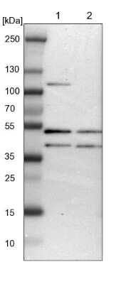 Western Blot: ISY1 Antibody [NBP1-81865] - Lane 1: NIH-3T3 cell lysate (Mouse embryonic fibroblast cells). Lane 2: NBT-II cell lysate (Rat Wistar bladder tumor cells).