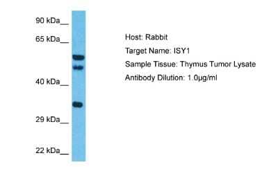 Western Blot: ISY1 Antibody [NBP2-87640] - Host: Rabbit. Target Name: ISY1. Sample Type: Thymus Tumor lysates. Antibody Dilution: 1.0ug/ml
