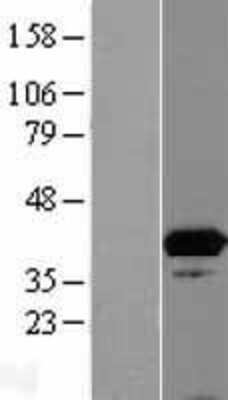 Western Blot: ISY1 Overexpression Lysate (Adult Normal) [NBL1-12055] Left-Empty vector transfected control cell lysate (HEK293 cell lysate); Right -Over-expression Lysate for ISY1.